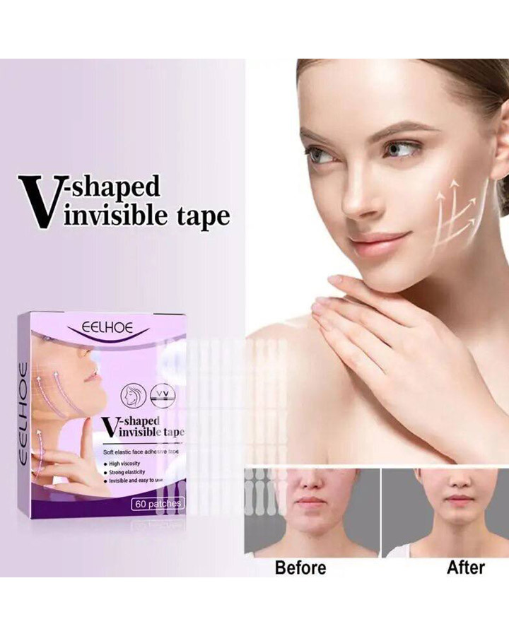 چسب زاویه فک مدل Vinvisible کد 6015